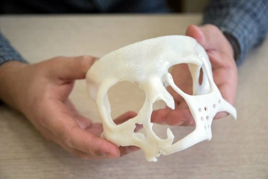 Эндопротез, созданный с помощью 3d принтера