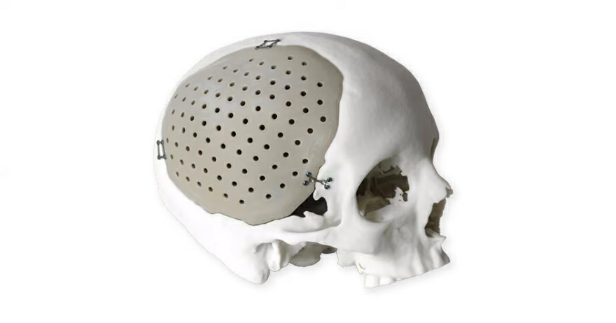 Модель реек в медицине